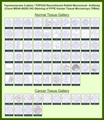 Topoisomerase II alpha (Proliferation & Drug-Resistance Marker) Recombinant Rabbit Monoclonal Antibody (MSVA-802R)