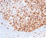 Topoisomerase II alpha (Proliferation and Drug-Resistance Marker) Recombinant Rabbit Monoclonal Antibody (TOP2A/4397R)