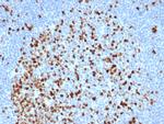 Topoisomerase II alpha Antibody in Immunohistochemistry (Paraffin) (IHC (P))