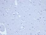 Topoisomerase II alpha Recombinant Rabbit Monoclonal Antibody (TOP2A, 6570R)
