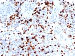 Topoisomerase II alpha (Proliferation and Drug-Resistance Marker) Antibody in Immunohistochemistry (Paraffin) (IHC (P))