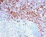 Topoisomerase II alpha (Proliferation and Drug-Resistance Marker) Antibody in Immunohistochemistry (Paraffin) (IHC (P))