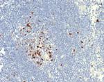 Topoisomerase II alpha (Proliferation and Drug-Resistance Marker) Recombinant Rabbit Monoclonal Antibody (TOP2A/7169R)