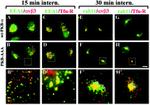 RAB11A Antibody in Immunocytochemistry (ICC/IF)