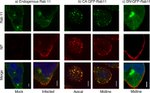 RAB11A Antibody in Immunohistochemistry (IHC)