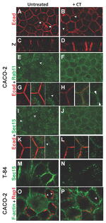 RAB11A Antibody in Immunocytochemistry (ICC/IF)