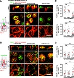 RAB11A Antibody in Immunocytochemistry (ICC/IF)