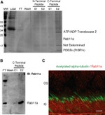 RAB11A Antibody in Western Blot, Immunohistochemistry (WB, IHC)