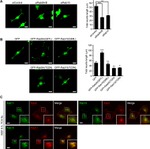RAB11A Antibody in Immunocytochemistry (ICC/IF)