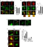 RAB11A Antibody in Immunocytochemistry (ICC/IF)