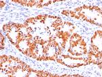 p53 Tumor Suppressor Protein Antibody in Immunohistochemistry (Paraffin) (IHC (P))