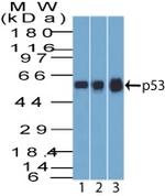 p53 Tumor Suppressor Protein Antibody in Western Blot (WB)