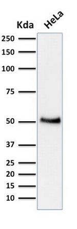p53 Tumor Suppressor Protein Antibody in Western Blot (WB)