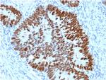 p53 (Tumor Suppressor Protein Antibody in Immunohistochemistry (Paraffin) (IHC (P))