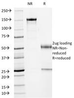 p53 (Tumor Suppressor Protein Antibody in SDS-PAGE (SDS-PAGE)
