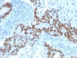 p53 (Tumor Suppressor Protein) Antibody in Immunohistochemistry (Paraffin) (IHC (P))