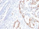 p53 Tumor Suppressor Protein Antibody in Immunohistochemistry (Paraffin) (IHC (P))
