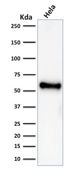p53 Tumor Suppressor Protein Antibody in Western Blot (WB)