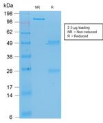 p53 Tumor Suppressor Protein Antibody in SDS-PAGE (SDS-PAGE)