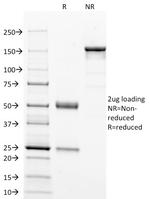 p53 Tumor Suppressor Protein Antibody in SDS-PAGE (SDS-PAGE)