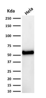 p53 Tumor Suppressor Protein Antibody in Western Blot (WB)