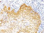 p53 Tumor Suppressor Protein Antibody in Immunohistochemistry (Paraffin) (IHC (P))