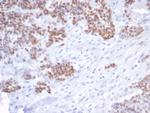 p53 Tumor Suppressor Protein Antibody in Immunohistochemistry (Paraffin) (IHC (P))
