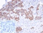 p53 Tumor Suppressor Protein Antibody in Immunohistochemistry (Paraffin) (IHC (P))