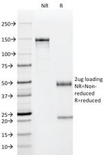 p53 Tumor Suppressor Protein Antibody in SDS-PAGE (SDS-PAGE)