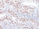 p53 Tumor Suppressor Protein Antibody in Immunohistochemistry (Paraffin) (IHC (P))