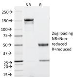 p53 Tumor Suppressor Protein Antibody in SDS-PAGE (SDS-PAGE)