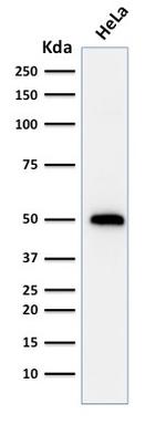 p53 Tumor Suppressor Protein Antibody in Western Blot (WB)