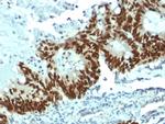 p53 Tumor Suppressor Protein Antibody in Immunohistochemistry (Paraffin) (IHC (P))