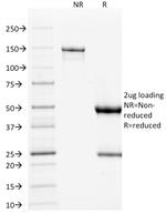 p53 Tumor Suppressor Protein Antibody in SDS-PAGE (SDS-PAGE)