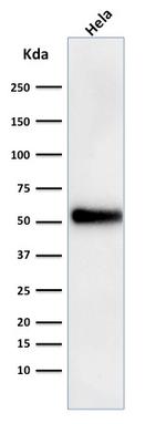 p53 Tumor Suppressor Protein Antibody in Western Blot (WB)
