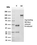 p53 Tumor Suppressor Protein Antibody in SDS-PAGE (SDS-PAGE)