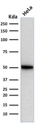 p53 Tumor Suppressor Protein Antibody in Western Blot (WB)