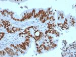 p53 Tumor Suppressor Protein Recombinant Rabbit Monoclonal Antibody (TP53, 2092R)