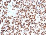 p53 (Tumor Suppressor Protein) Recombinant Rabbit Monoclonal Antibody (TP53/3890R)