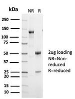 p53 (Tumor Suppressor Protein) Antibody in SDS-PAGE (SDS-PAGE)