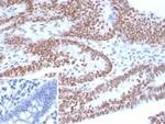 p53 (Tumor Suppressor Protein) Antibody in Immunohistochemistry (Paraffin) (IHC (P))