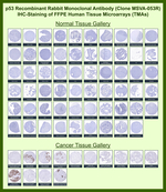 p53 Tumor Suppressor Protein Antibody in Immunohistochemistry (Paraffin) (IHC (P))