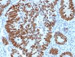 p53 Tumor Suppressor Protein Antibody in Immunohistochemistry (Paraffin) (IHC (P))