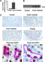 PAX2 Antibody in Immunohistochemistry (IHC)