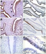PAX2 Antibody in Immunohistochemistry (Paraffin) (IHC (P))