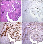 PAX2 Antibody in Immunohistochemistry (Paraffin) (IHC (P))