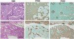 PAX2 Antibody in Immunohistochemistry (IHC)