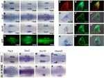 PAX2 Antibody in Immunohistochemistry (Frozen) (IHC (F))
