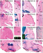 PAX2 Antibody in Immunohistochemistry (IHC)