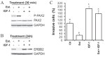 PAX2 Antibody in Western Blot (WB)